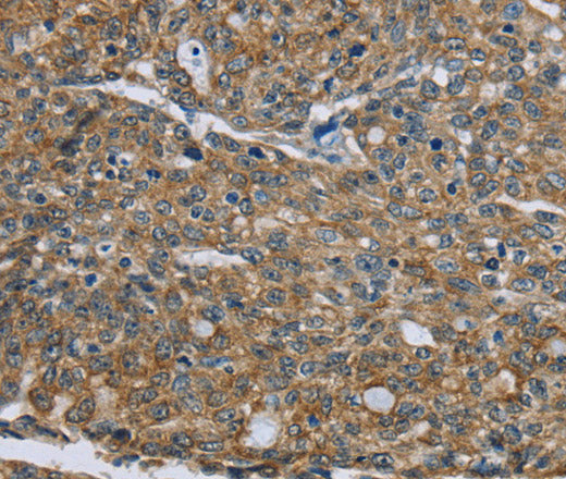Anti-Human/Mouse/Rat CK-5 Antibody - ABMIUM