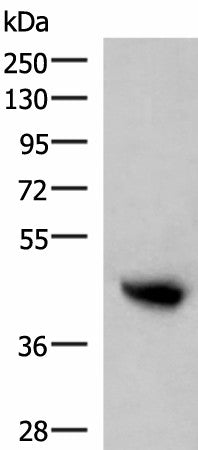 Western blot analysis of Human plasma solution using KIR2DL5A Polyclonal Antibody at dilution of 1:800