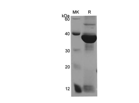SDS-PAGE analysis of Human CA199(FUT3) proteins, 2 μg/lane of Recombinant Human CA199(FUT3) proteins was resolved with SDS-PAGE under reducing conditions, showing bands at 40.9 kDa.