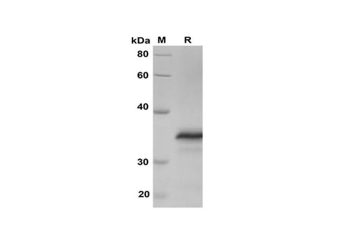 SDS-PAGE analysis of Human Fas proteins, 2 μg/lane of Recombinant Human Fas proteins was resolved with SDS-PAGE under reducing conditions, showing bands at 35 kDa.