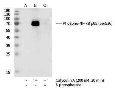 Anti-Human RELA Antibody [B307] - ABMIUM