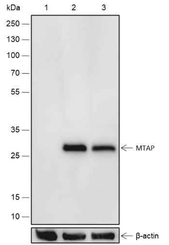 Anti-Human/Mouse MTAP Antibody [A519] - ABMIUM