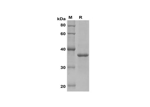 SDS-PAGE analysis of Rat IL-18 proteins, 2 μg/lane of Recombinant Rat IL-18 proteins was resolved with SDS-PAGE under reducing conditions, showing bands at 37 kDa.