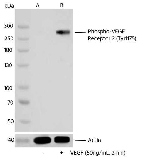 Anti-Human KDR Antibody [B311] - ABMIUM