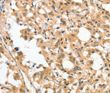 Anti-Human/Mouse/Rat APTX Antibody - ABMIUM