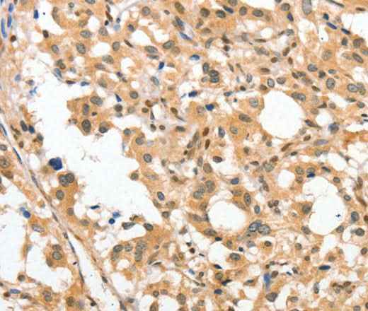 Anti-Human/Mouse/Rat APTX Antibody