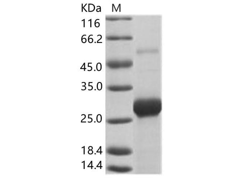 Recombinant EBOV (subtype Bundibugyo, strain Uganda 2007) VP24 Protein (His Tag) - ABMIUM