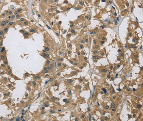 Anti-Human DSG2 Antibody - ABMIUM