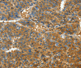 Anti-Human TNFSF13B Antibody - ABMIUM