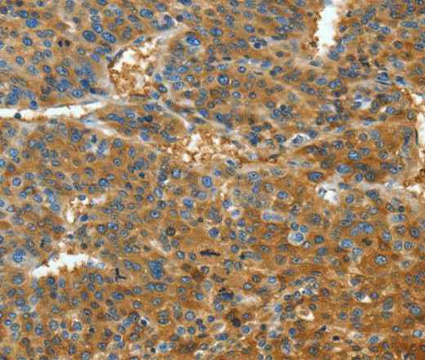 Anti-Human TNFSF13B Antibody