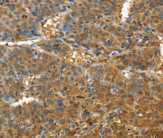 Anti-Human TNFSF13B Antibody - ABMIUM
