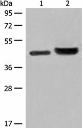 Western blot analysis of 231 cell and Human fetal liver tissue lysates using INPP1 Polyclonal Antibody at dilution of 1:500