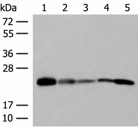 Western blot analysis of 293T 231 HUVEC Hela and A549 cell lysates using MT-CO2 Polyclonal Antibody at dilution of 1:400