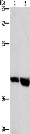 Anti-Human/Mouse GPR182 Antibody - ABMIUM