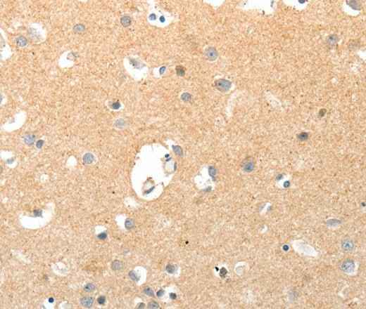 Anti-Human TNXB Antibody