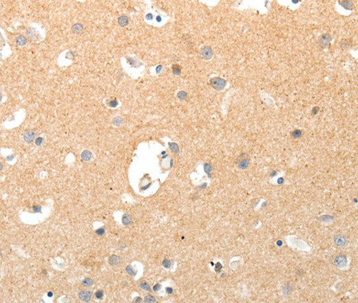 Anti-Human TNXB Antibody - ABMIUM