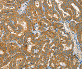Anti-Human/Mouse RAB25 Antibody - ABMIUM