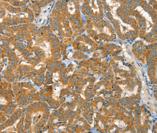 Anti-Human/Mouse RAB25 Antibody - ABMIUM