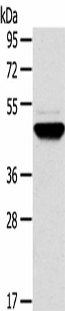 Anti-Human/Mouse TM7SF2 Antibody - ABMIUM