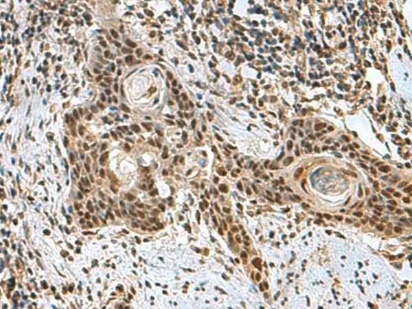 Anti-Human/Mouse PRPF40A Antibody
