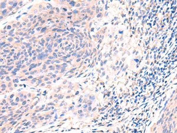 Anti-Human ESM1 Antibody