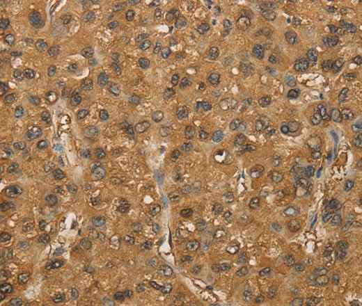 Anti-Human/Mouse SETD2 Antibody