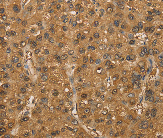 Anti-Human/Mouse SETD2 Antibody - ABMIUM