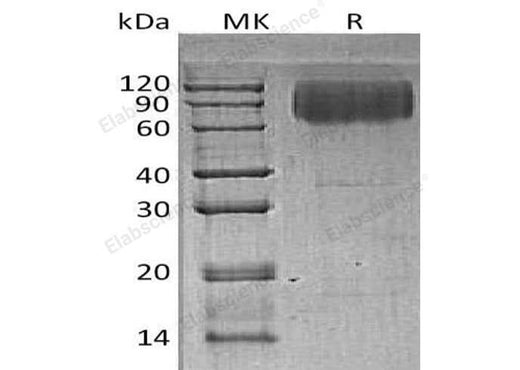 Recombinant Human LAMP2/CD107b Protein (His Tag) - ABMIUM