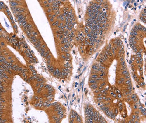 Anti-Human CRISP3 Antibody - ABMIUM