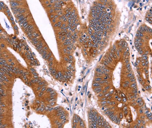 Anti-Human CRISP3 Antibody - ABMIUM