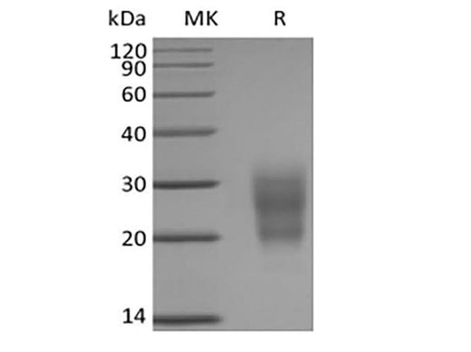 Recombinant Mouse NKG2-D type II Integral Membrane Protein/NKG2D/CD314 (N-6His) - ABMIUM