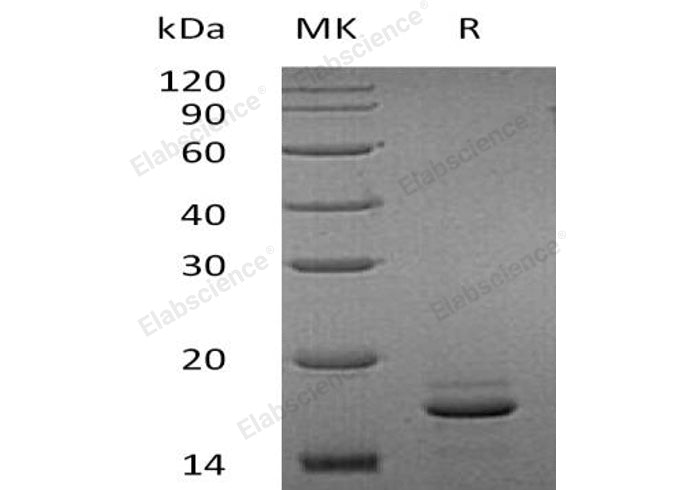 Recombinant Human EIF4EBP2 Protein (His Tag) - ABMIUM