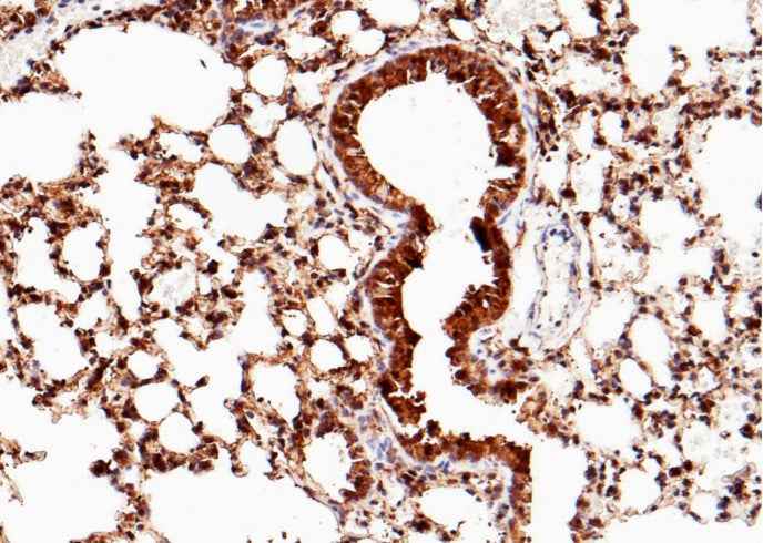 Anti-Mouse SFTPD Antibody [B423] - ABMIUM