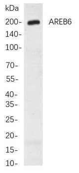 Anti-Human/Rat AREB6 Antibody [B776]