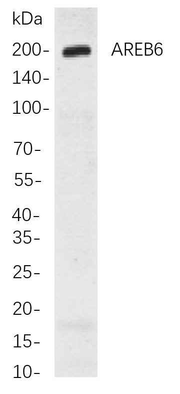 Anti-Human/Rat AREB6 Antibody [B776] - ABMIUM