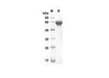 SDS-PAGE analysis of Mouse Lbp proteins, 2 μg/lane of Recombinant Mouse Lbp proteins was resolved with an SDS-PAGE under reducing conditions, showing bands at 52.8 kDa.