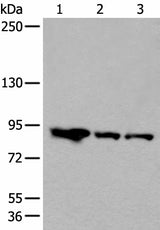 Western blot analysis of Mouse brain tissue Human cerebella tissue A549 cell lysates using VPS35 Polyclonal Antibody at dilution of 1:200