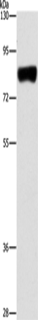 Anti-Human ARHGAP25 Antibody - ABMIUM