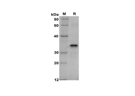SDS-PAGE analysis of Human ErbB4/HER4 proteins, 2 μg/lane of Recombinant Human ErbB4/HER4 proteins was resolved with SDS-PAGE under reducing conditions, showing bands at 35 kDa.