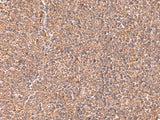 Immunohistochemistry of paraffin-embedded Human tonsil tissue using RABEPK Polyclonal Antibody at dilution of 1:65(×200)