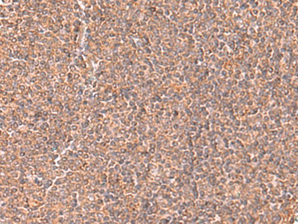 Immunohistochemistry of paraffin-embedded Human tonsil tissue using RABEPK Polyclonal Antibody at dilution of 1:65(×200)