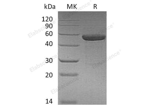 Recombinant Human IL15RA&IL15 Fusion Protein (Fc Tag) - ABMIUM