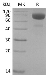 Recombinant Cynomolgus IL-4 Receptor Subunit Alpha/IL-4RA (C-Fc) - ABMIUM