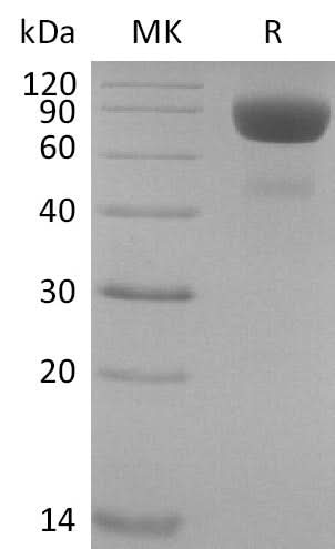 Recombinant Cynomolgus IL-4 Receptor Subunit Alpha/IL-4RA (C-Fc) - ABMIUM