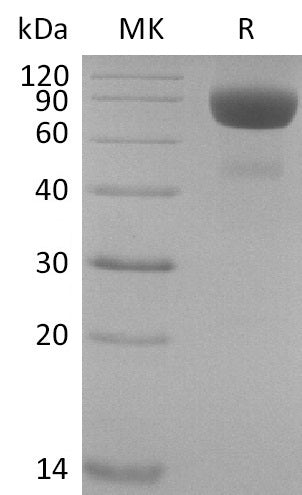 Recombinant Cynomolgus IL-4 Receptor Subunit Alpha/IL-4RA (C-Fc) - ABMIUM