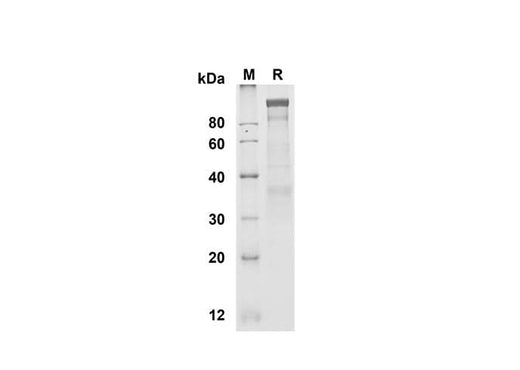 SDS-PAGE analysis of Human PSMA proteins , 2 μg/lane of Recombinant Human PSMAL proteins was resolved with SDS-PAGE under reducing conditions , showing bands at 100-110 kDa.