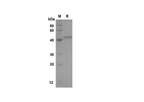SDS-PAGE analysis of Human LEPTIN proteins, 2 μg/lane of Recombinant Human LEPTIN proteins was resolved with SDS-PAGE under reducing conditions, showing bands at 45 kDa.