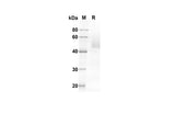 SDS-PAGE analysis of Human FASL proteins, 2 μg/lane of Recombinant Human FASL proteins was resolved with an SDS-PAGE under reducing conditions, showing bands at 41.17 kDa.
