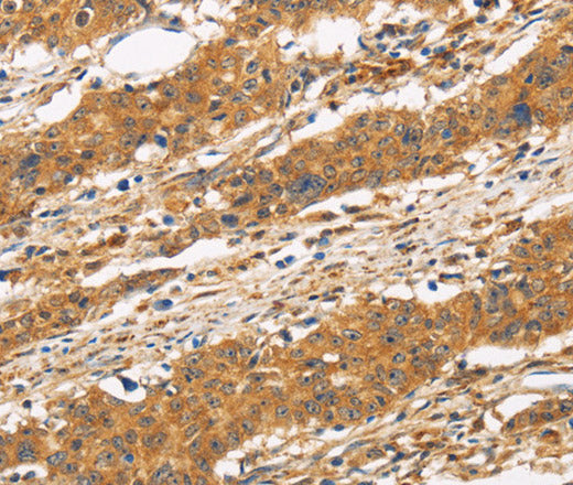 Anti-Human CD22 Antibody - ABMIUM
