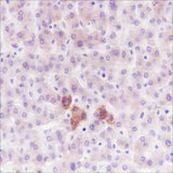 Anti-Human/Mouse PDK1 Antibody [A325]